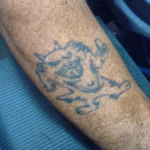 a photo of the 41 year old black ink tattoo before any laser tattoo removal treatments