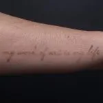 A photo of the forearm script tattoo reading "My Work of Art is My Life" after one treatment, 8 weeks later.