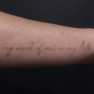 A photo of the forearm script tattoo reading "My Work of Art is My Life" after one treatment, 8 weeks later.