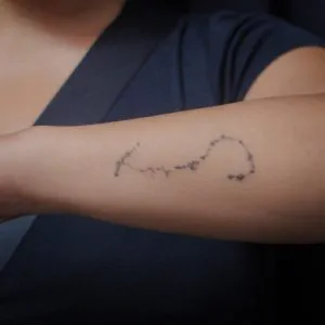 A photo of the constellation tattoo on the forearm after 1 treatment, 14 weeks later.