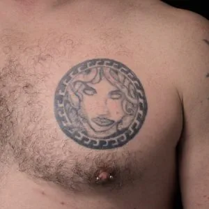 A photo of the Medusa tattoo on the chest, before any laser tattoo removal treatments.