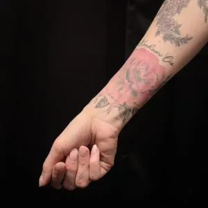 A photo of a floral rose tattoo after 2 laser tattoo removal treatments, 11 weeks later