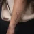 A photo of a Fine Line 2 years tattoo on the forearm on a person with FitzPatrick Skin Type iv type 1. This client is hoping for Complete Removal