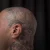 A photo of a 15 months old tattoo on the Scalp on a person with FitzPatrick Skin Type ii 12 Weeks after their  treatment. This client is hoping for Complete Removal