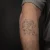 A photo of a Blackwork 41 Years old tattoo on the forearm on a person with FitzPatrick Skin Type iii 11 Weeks after their  treatment. This client is hoping for Complete Removal