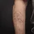 A photo of a Blackwork 41 Years old tattoo on the forearm on a person with FitzPatrick Skin Type iii 12 Weeks after their  treatment. This client is hoping for Complete Removal