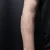 A photo of a Linework 41 Years tattoo on the forearm on a person with FitzPatrick Skin Type iii 9 Months after their  treatment. This client is hoping for Complete Removal