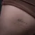 A photo of a Script 9 Years old tattoo on a person with FitzPatrick Skin Type iii 8 Weeks after their  treatment. This client is hoping for Complete Removal
